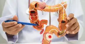 Câncer colorretal: entenda o impacto do consumo de ultraprocessados na saúde intestinal