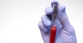 Foto: (Vladislav Polishchuk/istock)