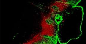 Antibiótico pode ser esperança no tratamento do Parkinson