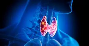 Sinais comuns que podem esconder câncer