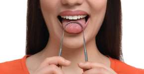 Foto: (Imagem sem texto alternativo disponivel ID [2456314])