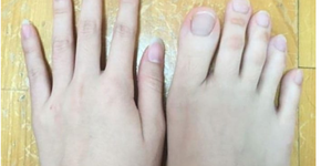 Foto: (Imagem sem texto alternativo disponivel ID [1432457])