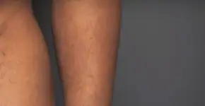 Foto: (Imagem sem texto alternativo disponivel ID [1501898])