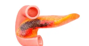 Foto: (luismmolina/istock)