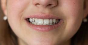 Foto: (Anastasiya Vialko/iStock)