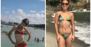 Jovem que chegou a pesar 29 kg conta como venceu a anorexia