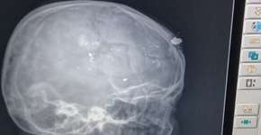 Foto: (Divulgação/Polícia Civil)