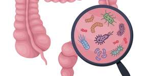 Foto: (AlonzoDesign/istock)