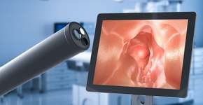 Foto: (PhonlamaiPhoto/istock)