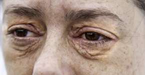 Foto: (fotocelia/istock)