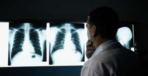 Foto: (Depositphotos/diego_cervo)