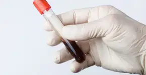 Foto: (mbz-photodesign/istock)