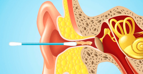 Foto: (Imagem sem texto alternativo disponivel ID [1554353])