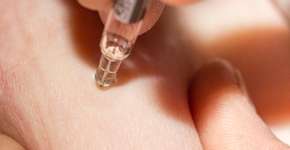 Médicos alertam para uso do ‘chip da beleza’; entenda