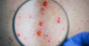 Foto: (Roman Didkivskyi/istock)