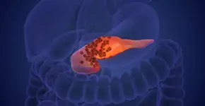 Foto: (iSTock/Silver Place)