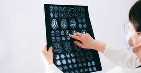 Idade biológica do cérebro: o que ela revela sobre sua expectativa de vida