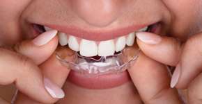 Foto: (Imagem sem texto alternativo disponivel ID [2458961])