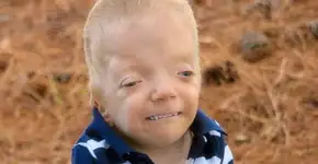 Mãe de menino com doença terminal luta contra memes com seu filho