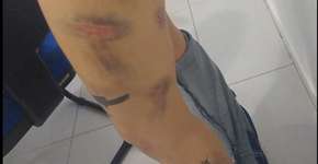 Jovem é preso por torturar e fazer a ex comer fezes de animais