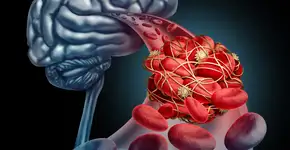 Foto: (lightsource/DepositPhotos)