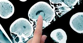 Foto: (Depositphotos)