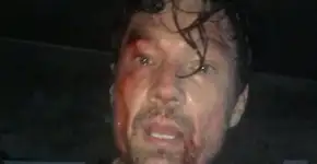 Ricardo Macchi publica foto “ferido” para ironizar Joice Hasselmann