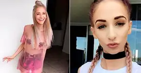 Modelo com anorexia revela ataques e faz apelo contra bullying