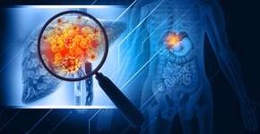 Foto: (iSTock/Mohammed Haneefa Nizamudeen)