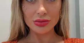Andressa Urach desabafa após procedimento nos olhos: ‘Medo de ficar cega’