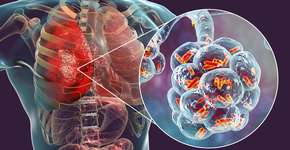 Foto: (Dr_Microbe/istock)