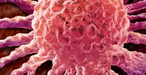 Sintomas comuns que podem indicar câncer