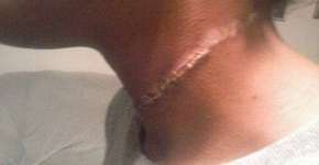 Garota negra é enlaçada pelo pescoço dentro de escola