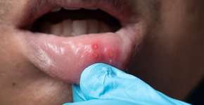 Foto: (showcake/istock)