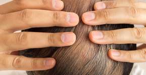 Consumo deste alimento provoca queda de cabelo