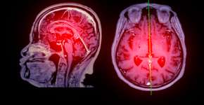 Foto: (iStock/mr.suphachai praserdumrongchai)