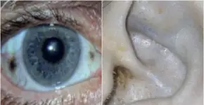 Foto: (reprodução/NHS)