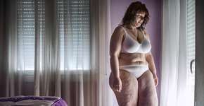 Série de fotos retrata trajetória de uma mulher que perdeu 54 kg