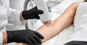 Foto: (Imagem sem texto alternativo disponivel ID [2726189])