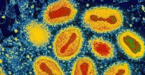 Identificada uma forma grave de mpox comedora de carne