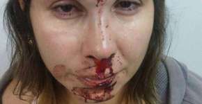 Foto: (Imagem sem texto alternativo disponivel ID [1100593])