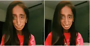 Autora motivacional Lizzie Velasquez é vítima de bullying no TikTok