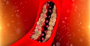 Foto: (Imagem sem texto alternativo disponivel ID [2349739])