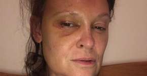 Foto: (reprodução/Brain Tumor Research)