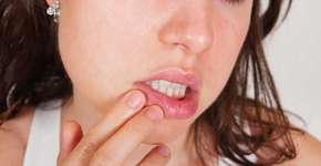 DSTs da boca: saiba os sintomas e como prevenir