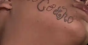 Jovem inicia remoção de tatuagem feita à força no rosto pelo ex: ‘Livre’