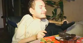 Conheça o cara que receberá o primeiro transplante de cabeça do mundo