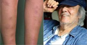 Foto: (reprodução/Instagram)