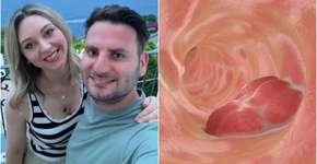 Foto: (reprodução/bowelcanceruk)