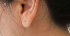 Foto: (Imagem sem texto alternativo disponivel ID [279263])